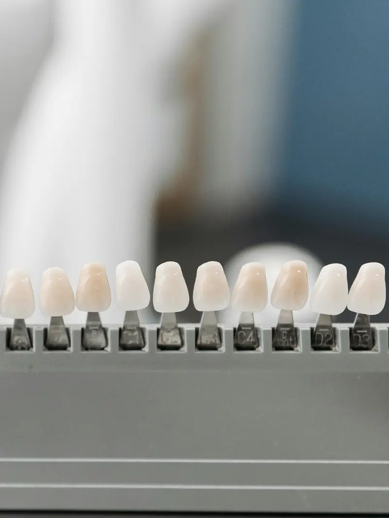 Porcelain Veneers